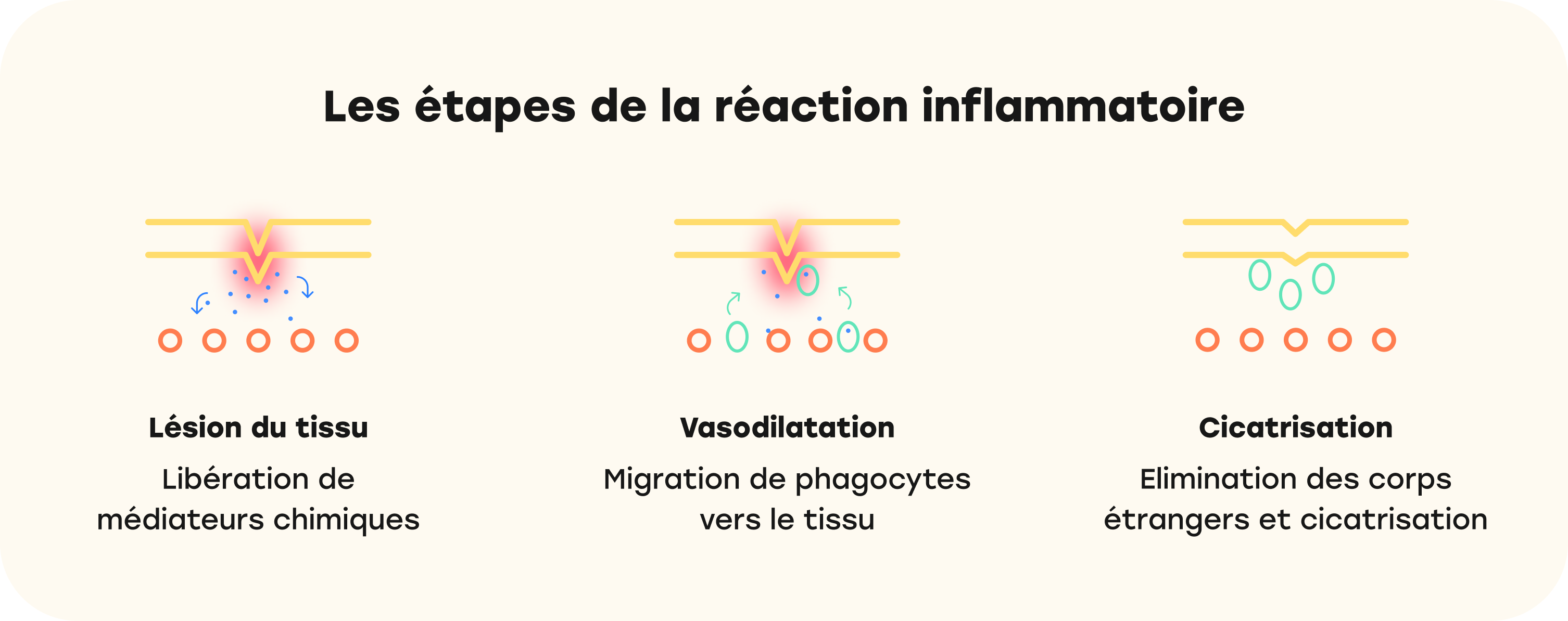 Les antiinflammatoires, ça marche comment